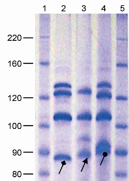 SDS-PAGE analysis of HMW-GS from culivar Noe
